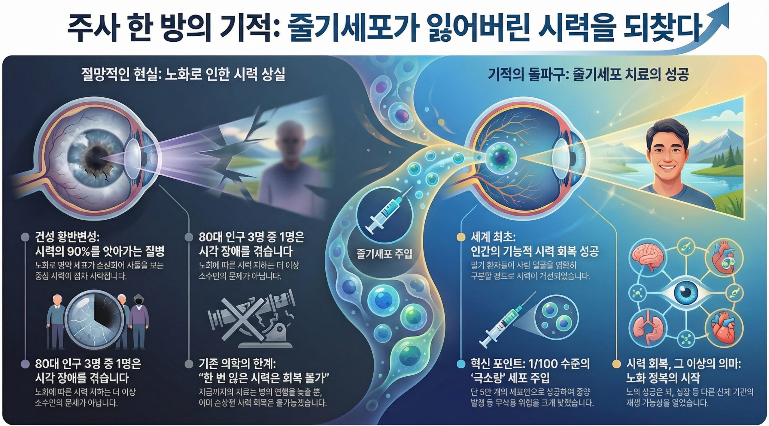 주사한방 줄기세포 시력 회복